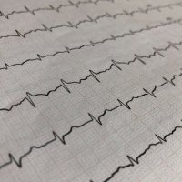 EKG-Schreiber EKG-Schreiber